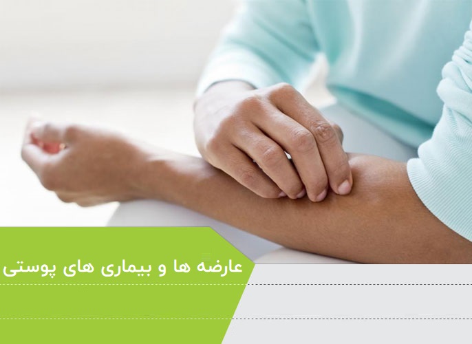 عارضه ها و بیماری های پوستی